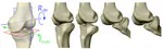 An Articulated Statistical Shape Model of the Human Knee