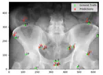 Anatomical Landmark Detection From X-Ray Images Using Convolutional Neural Networks