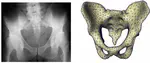 Atlas-based 3D-Shape Reconstruction from X-Ray Images