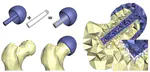 Robust and Intuitive Meshing of Bone Implant Compounds