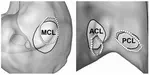 Segmentation of Bony Structures With Ligament Attachment Sites