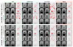 Unsupervised Detection of Disturbances in 2D Radiographs
