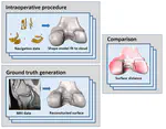 Validation of Three Dimensional Models of the Distal Femur Created From Surgical Navigation Point Cloud Data for Intraoperative and Postoperative Analysis of Total Knee Arthroplasty