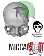 Best Paper Award at MICCAI Grand Challenge AutoImplant 2020